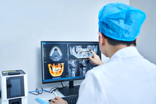 Best Knocked-Out Tooth (Avulsed Tooth) Treatment in Carbondale, PA